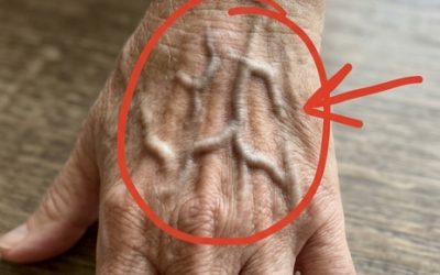 Jos suonesi ovat näkyvissä, tässä on mitä se tarkoittaa