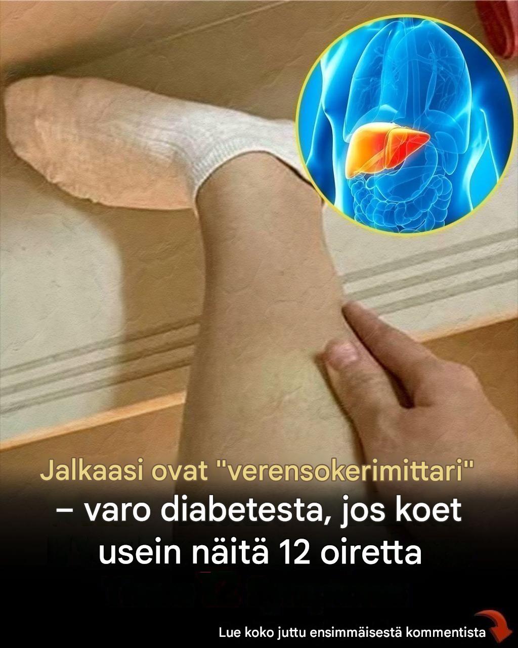 Jalkasi ovat “verensokerimittari” – varo diabetekseen, jos koet usein nämä 12 oiretta