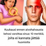 10 aivohalvauksen varoitusmerkkiä, jotka kannattaa havaita kuukausi etukäteen