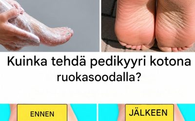 Luonnollinen hoito: kuinka tehdä kotitekoinen pedikyyri ruokasoodalla onnistuneesti